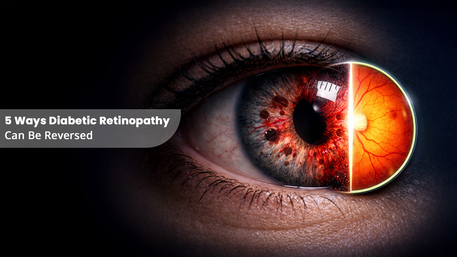 5 Ways Diabetic Retinopathy Can Be Reversed